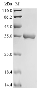 SDS-PAGE