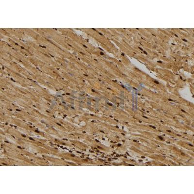 Валидация Affinity DF6115 - 17333