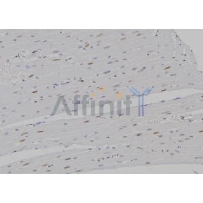 Валидация Affinity DF6940 - 18553