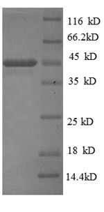 SDS-PAGE