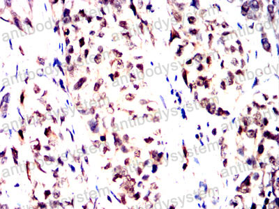 Валидация AntibodySystem RHB26401 (302)