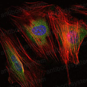 Валидация IF - AntibodySystem RHD06804