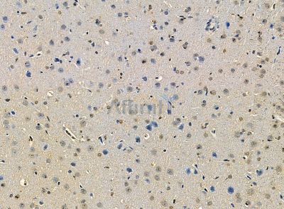 Валидация Affinity DF14307 - 10195