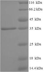 SDS-PAGE
