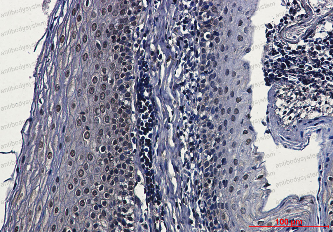 Валидация AntibodySystem RHF61501