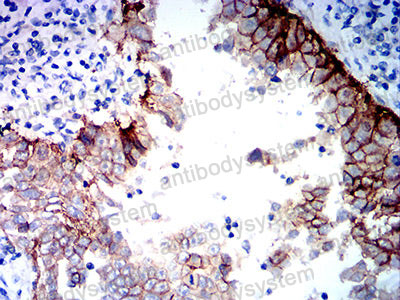 Валидация AntibodySystem RHE58401