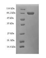 SDS-PAGE