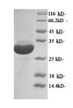 SDS-PAGE