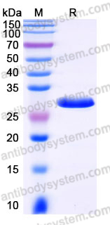 YHJ37701, SDS-PAGE