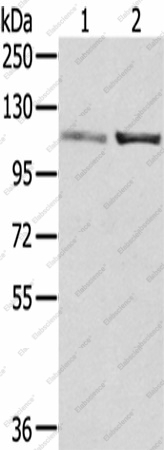 Вестерн-блоттинг, SENP7, клетки A172 и 231