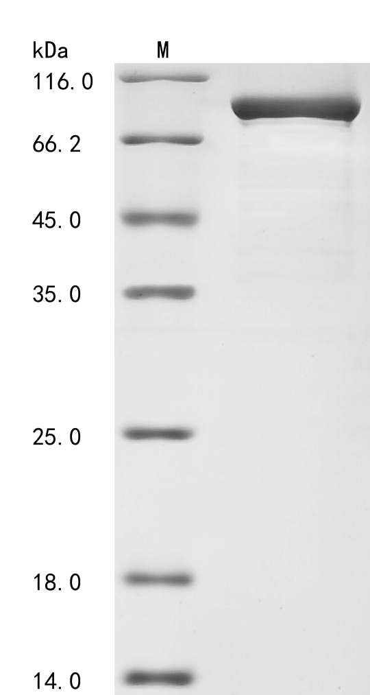 SDS-PAGE