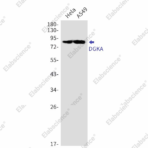 Вестерн-блоттинг, DGKA, клетки HeLa и A549