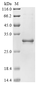 SDS-PAGE