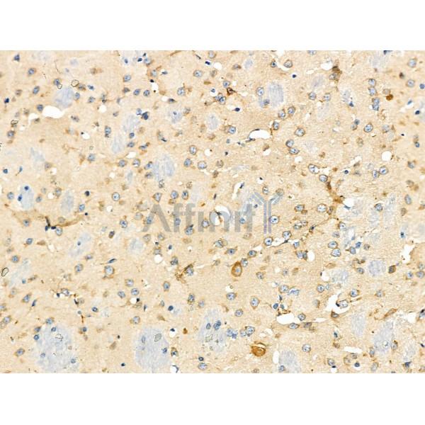 Валидация Affinity DF4159 - 15485