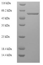 SDS-PAGE