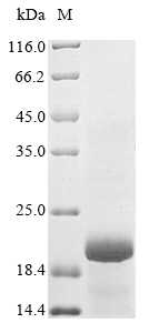 SDS-PAGE