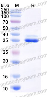EHD46901, SDS-PAGE