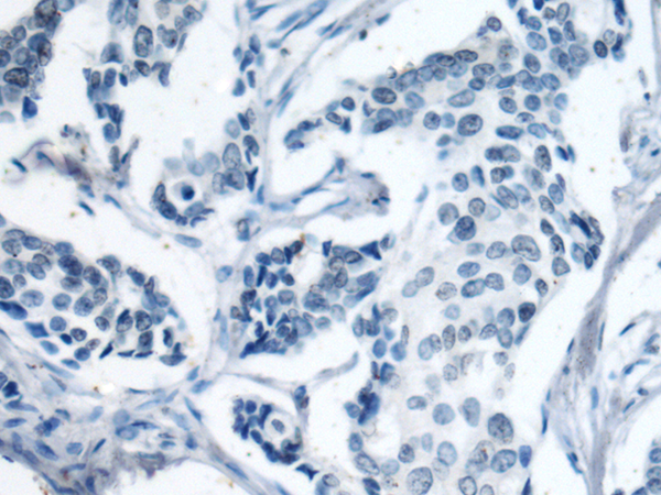 Валидация AssayVector ARM1479(1398)