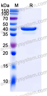 EHJ61301, SDS-PAGE