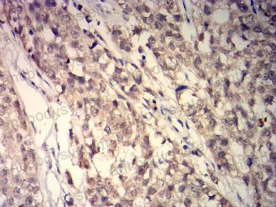 Валидация AntibodySystem RHC39303 (996)