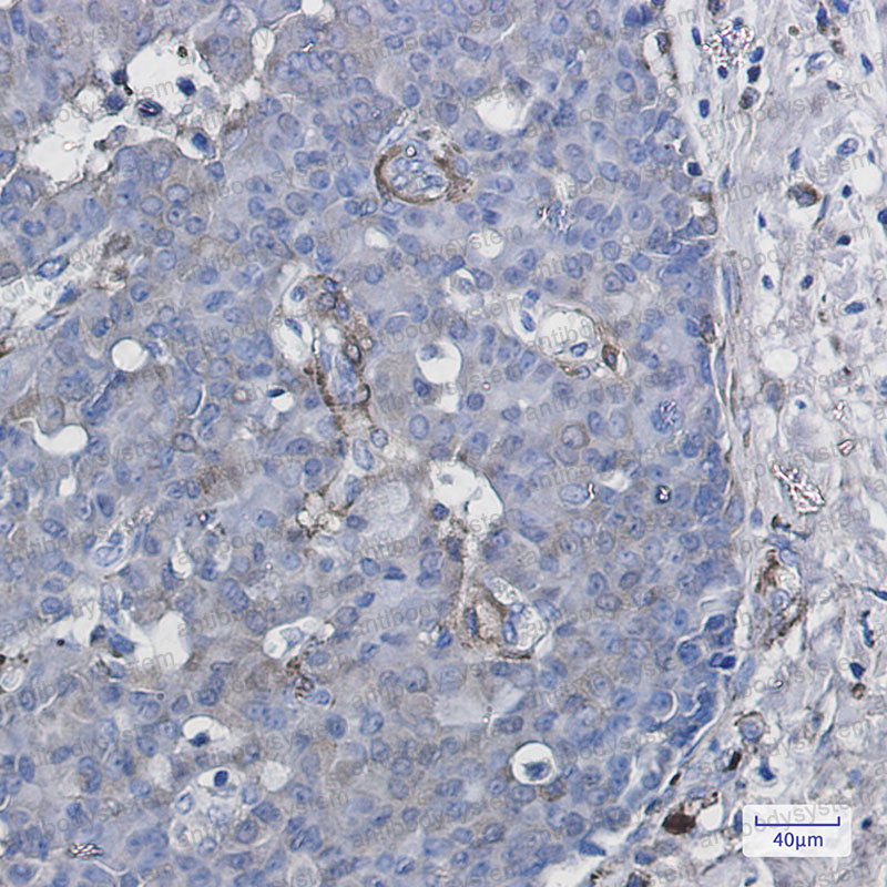 Валидация AntibodySystem RHH35001