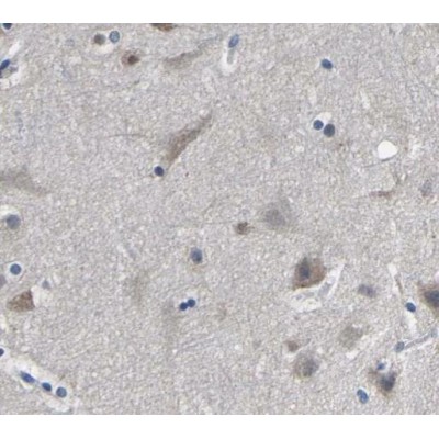 Валидация Affinity AF6118 - 3329