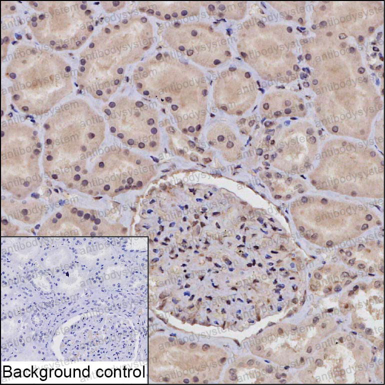 Валидация AntibodySystem RHK72701