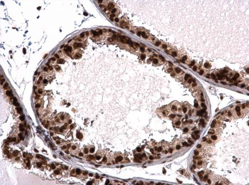 Валидация AssayVector ARM2686(5085)