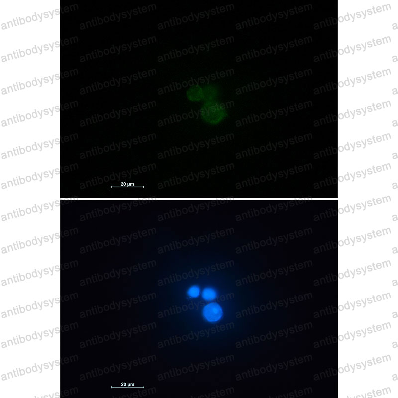 Валидация IF - AntibodySystem RHE40401