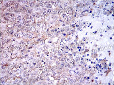 Валидация AntibodySystem RHD12202 (1345)