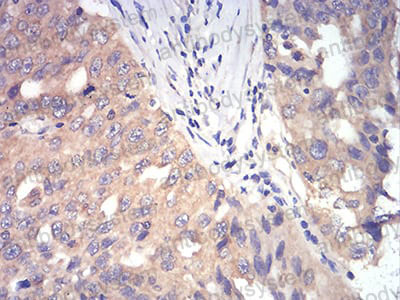 Валидация AntibodySystem RHA16101 (46)