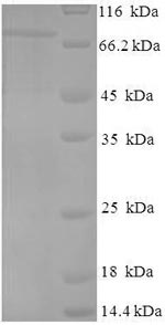 SDS-PAGE