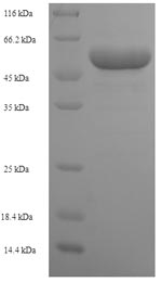 SDS-PAGE