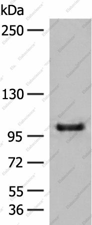 Вестерн-блоттинг, CTDP1, клетки HEPG2