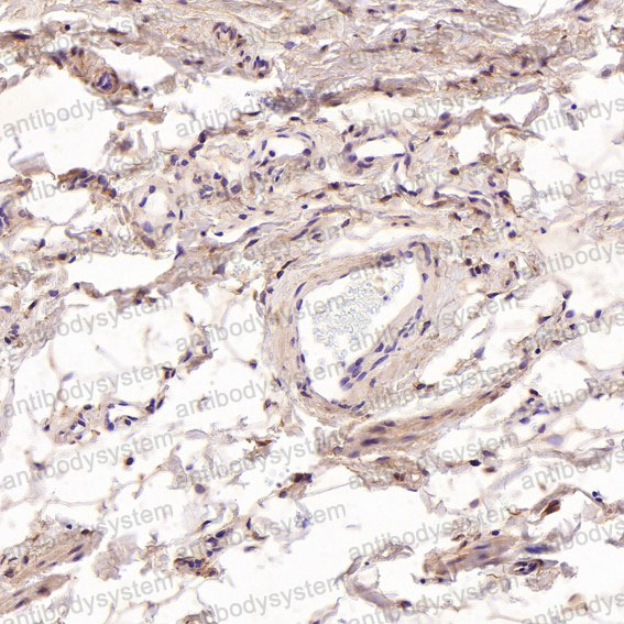 Валидация AntibodySystem RHK53201