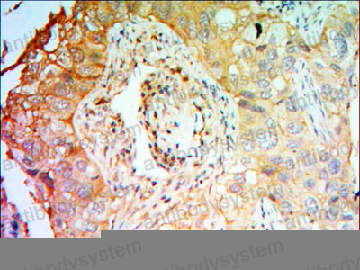 Валидация AntibodySystem RHG47801