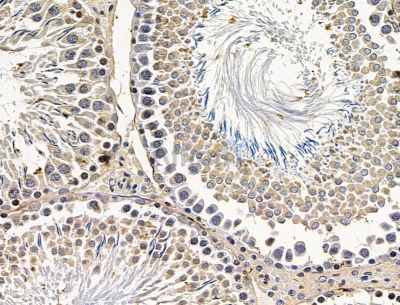 Валидация Affinity DF15214 - 11486