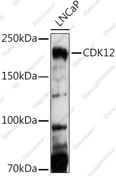 Вестерн-блоттинг, CDK12, клетки LNCaP