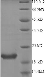 SDS-PAGE