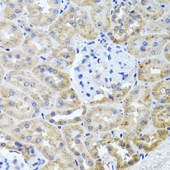 Иммуногистохимия, HDAC6, ткань почки крысы