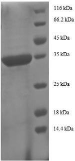 SDS-PAGE