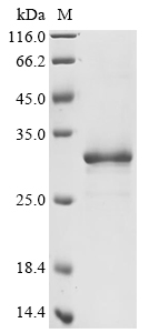SDS-PAGE