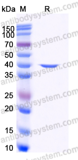 YHD74802, SDS-PAGE