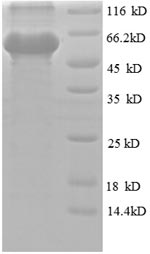 SDS-PAGE