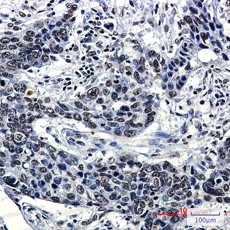 Валидация AntibodySystem RHC11305