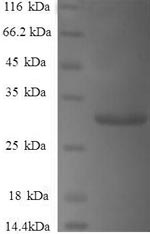 SDS-PAGE