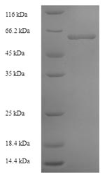 SDS-PAGE