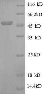 SDS-PAGE