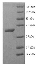 SDS-PAGE