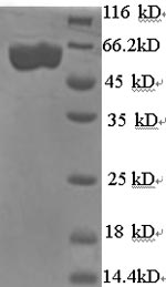 SDS-PAGE